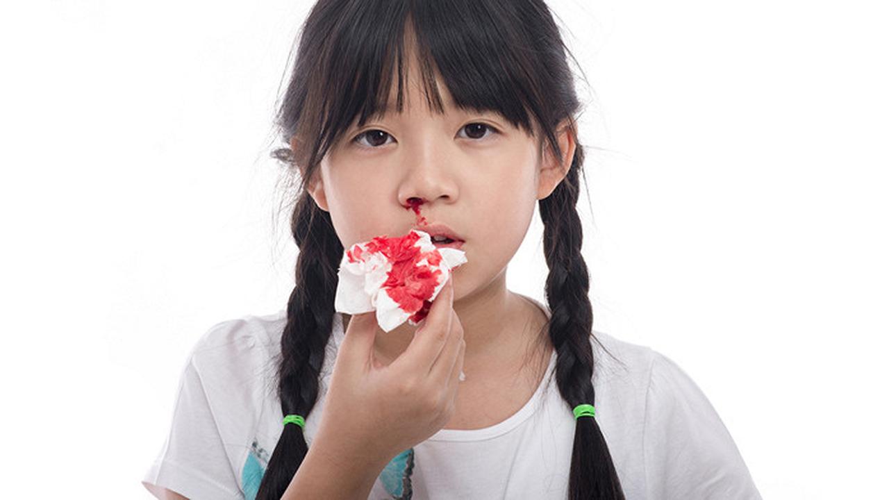 ребенок упал с дивана вниз головой из носа пошла кровь