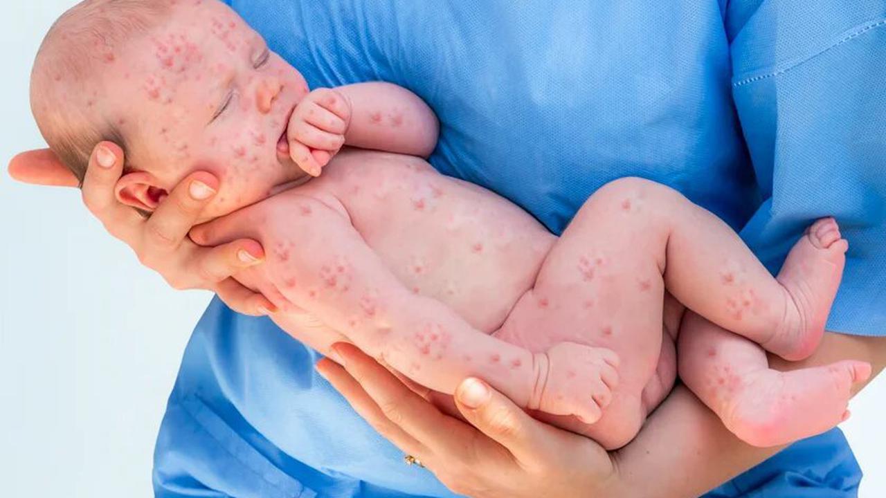 Голова горячая, а руки холодные — инфекционист назвал самые опасные симптомы гриппа у детей