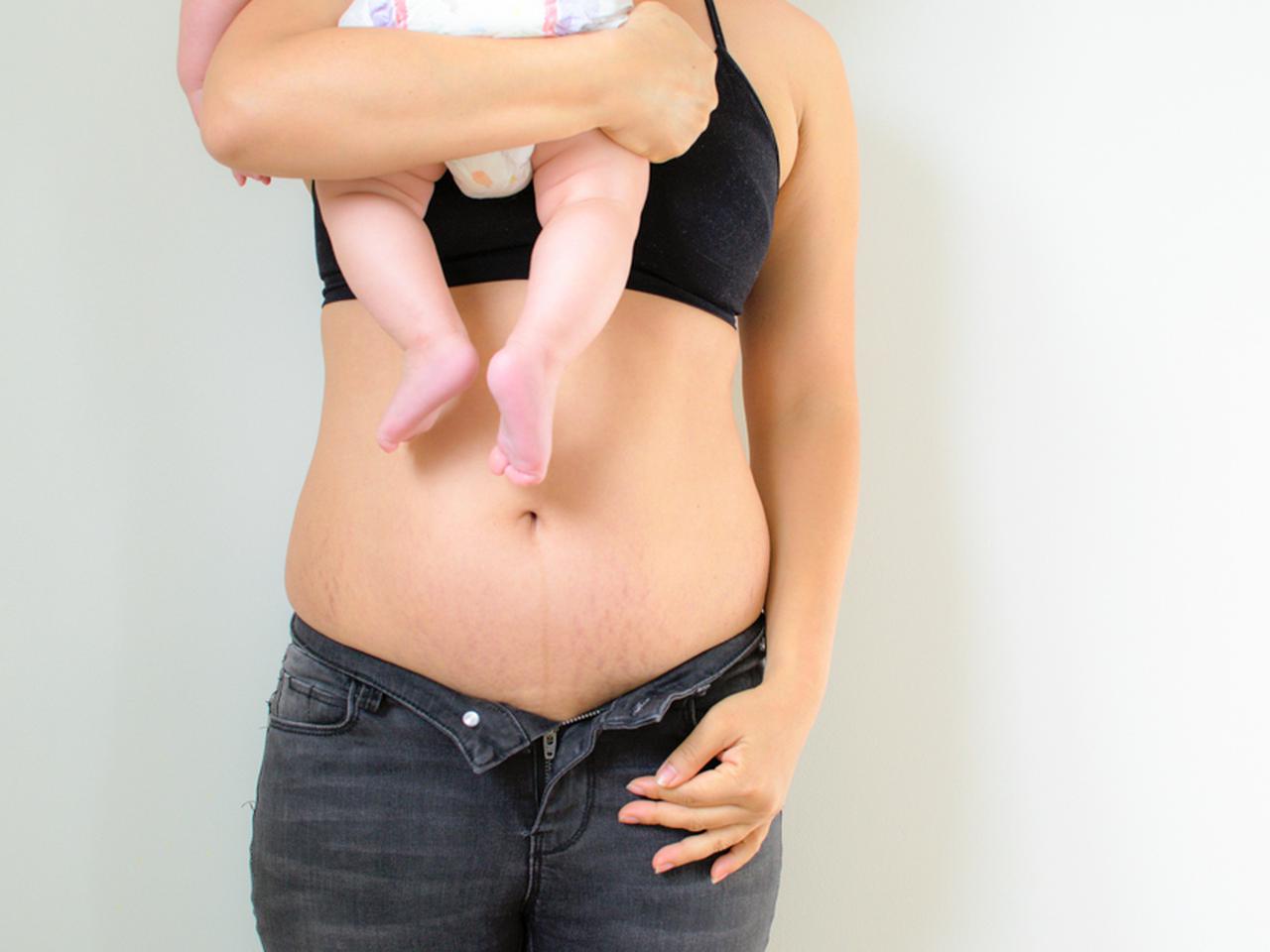 грудь обвисла после беременности фото 89